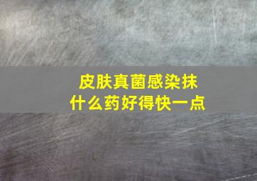 皮肤真菌感染抹什么药好得快一点