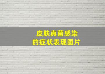 皮肤真菌感染的症状表现图片