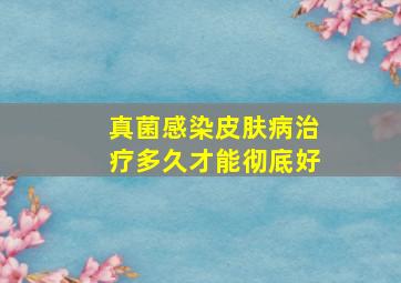 真菌感染皮肤病治疗多久才能彻底好