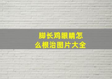 脚长鸡眼睛怎么根治图片大全