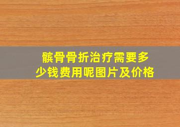 髌骨骨折治疗需要多少钱费用呢图片及价格